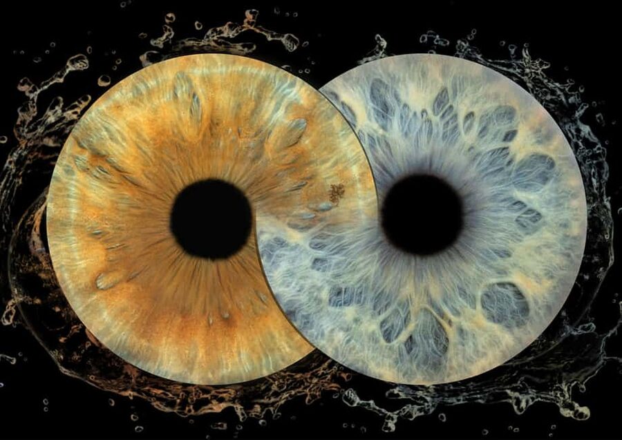 IRIS Photography (macro photo of your eye) - The 10-minute appointment, step by step